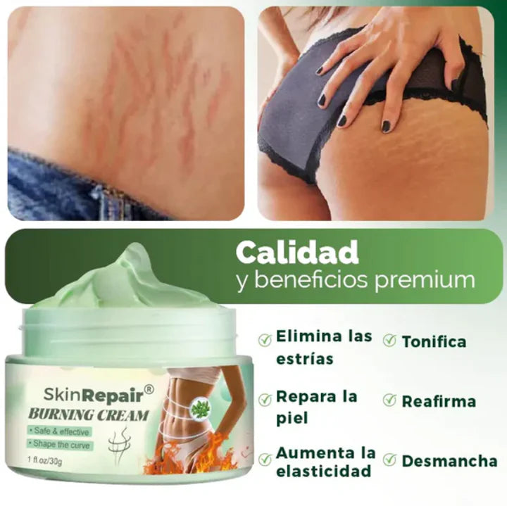 SkinRepair® Crema reafirmante antiestrías - reduce la apariencia y relieve💥HOY 50% DCTO