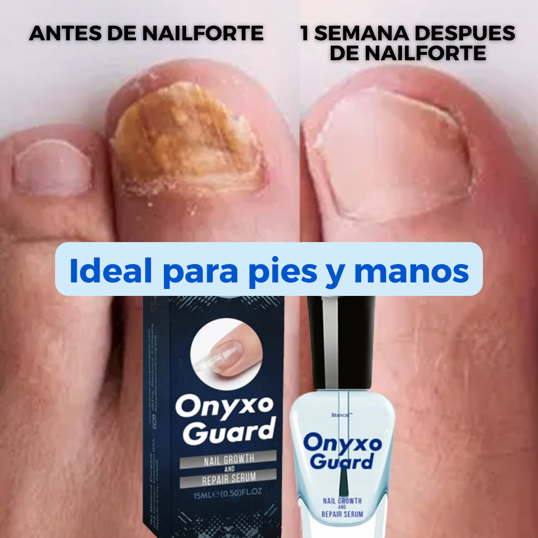 NailForte®: Uñas fuertes y sanas desde la primer aplicación