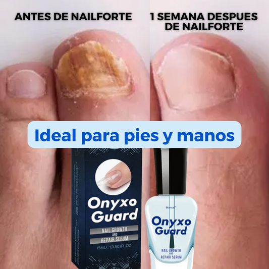 NailForte®: Uñas fuertes y sanas desde la primer aplicación