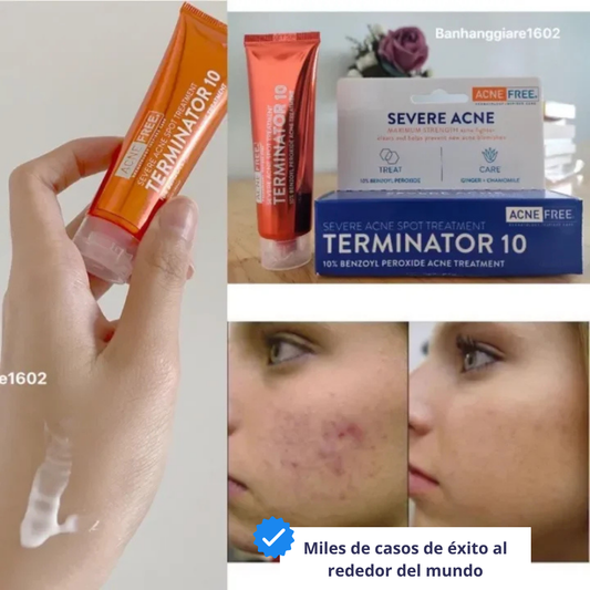 Terminator 10® Crema dermatológica que elimina gradualmente manchas severas de acné