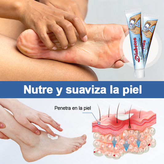Crema Terapéutica para Diabetes - Alivia el dolor y sana las heridas en la piel✨HOY 50% DCTO