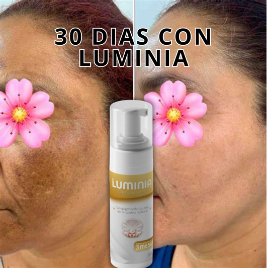 Luminia®: Aclarador Corporal y Facial Natural