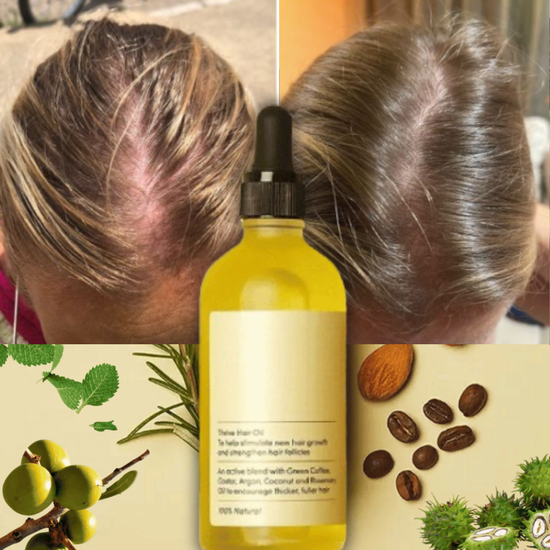 Extracto de Aceite de romero®: 🌿La solución natural a la caída del cabello