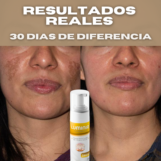 Kit Luminia® 2x1: Lleva el tratamiento completo que elimina las manchas