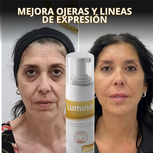 Luminia®: El secreto de una mirada perfecta