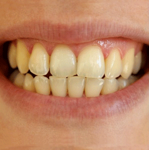 Pague 1 Y LLEVE 2🔥Crema dental blanqueadora con Niacinamida NiaSmile® - Sonrisa reluciente