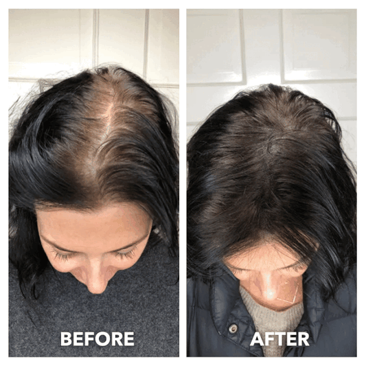 Aceite herbal para potenciar el crecimiento de cabello - Con romero y fenogreco extra fuerte✨H0Y 50% DCTO